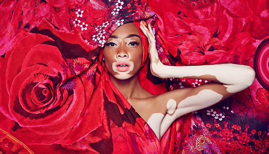 winnie-harlow-x-desigual-2